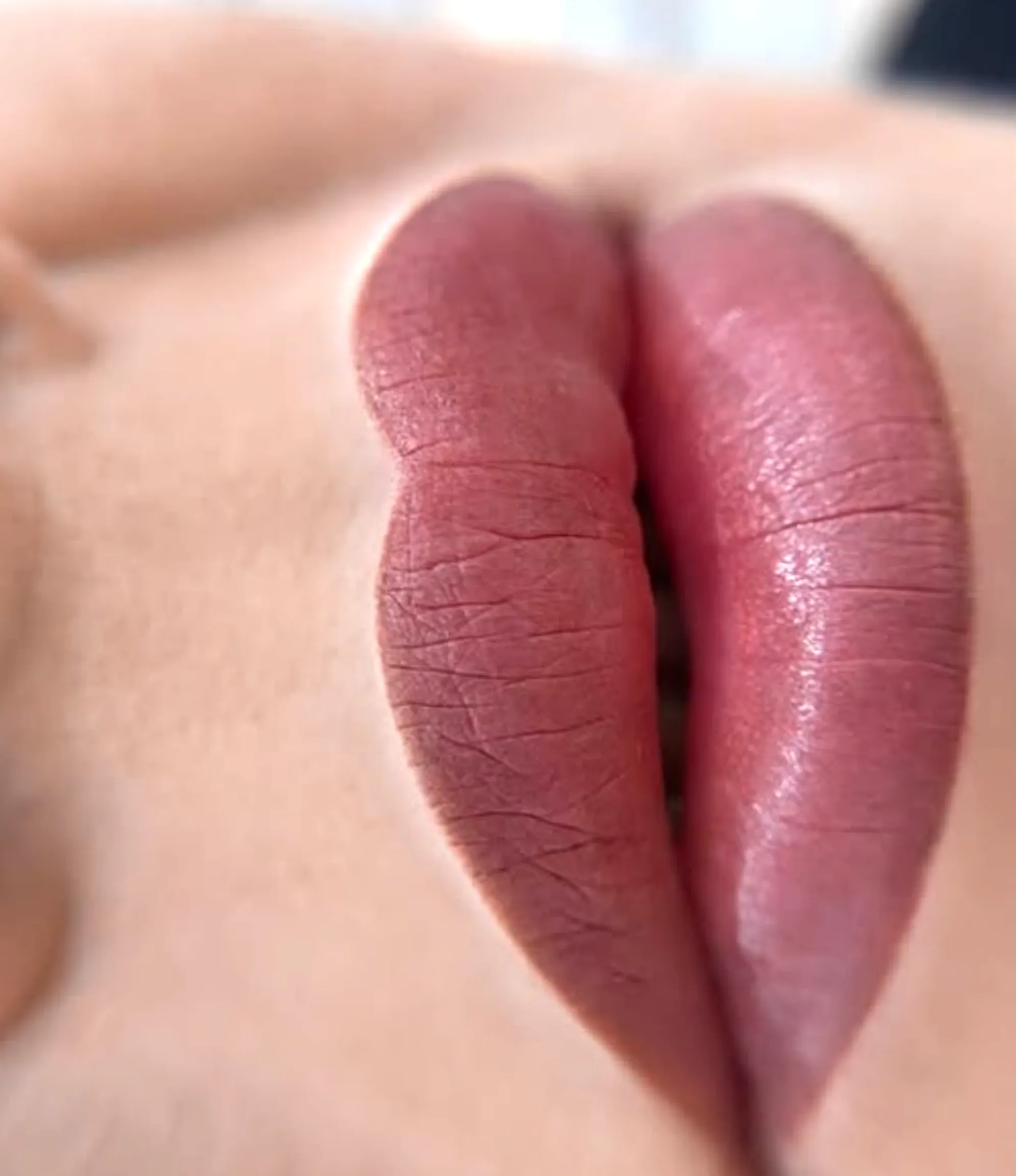 herpes simplex virus lip tattoo