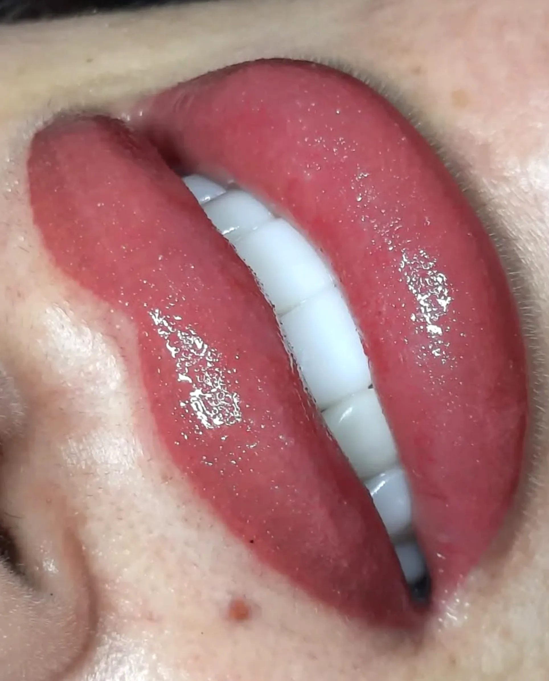 lip blush antiviral medication